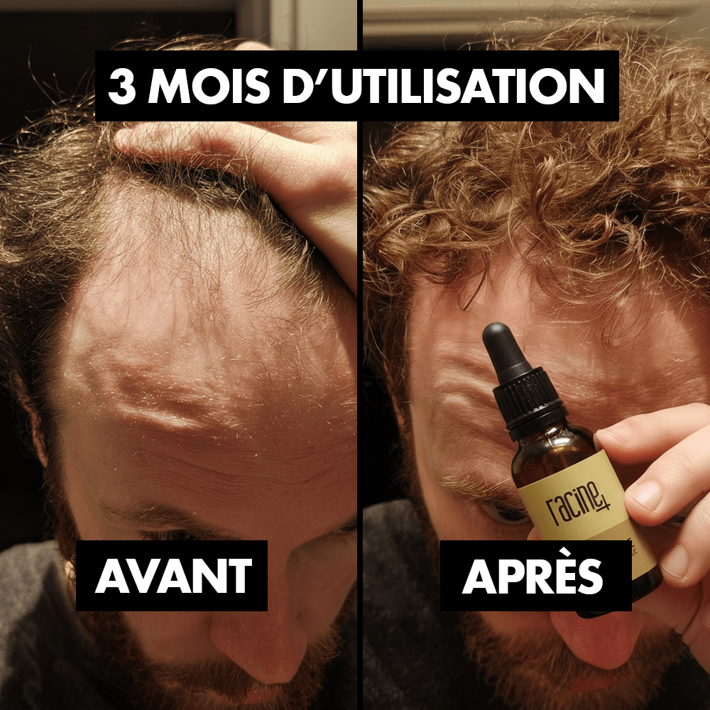 Sérum Racine+ | Gingembre repousse cheveux - Racine+